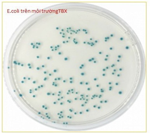 SỰ KHÁC NHAU GIỮA CÁC KỸ THUẬT THỬ NGHIỆM E.COLI